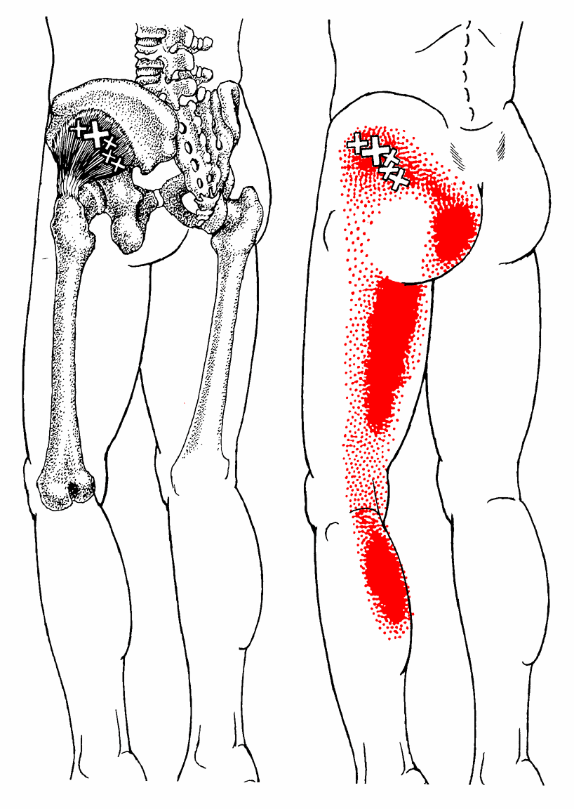 gluteus-minimus