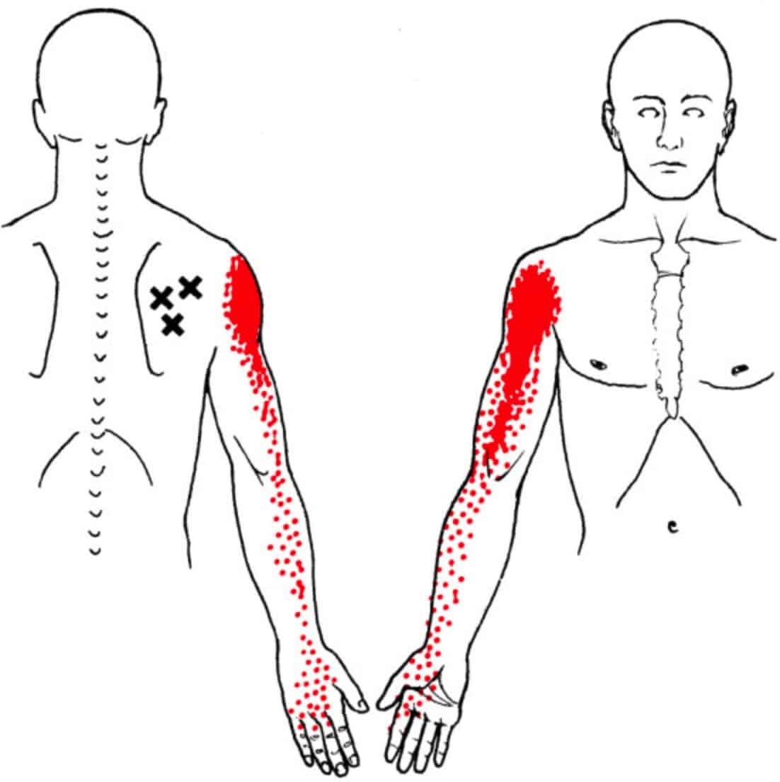 gluteus-minimus