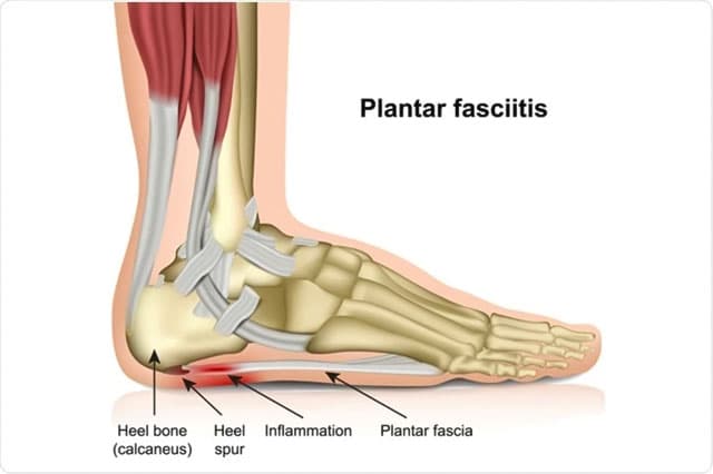 gluteus-minimus